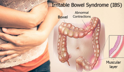 20 Foods That Make Irritable Bowel Syndrome Worse